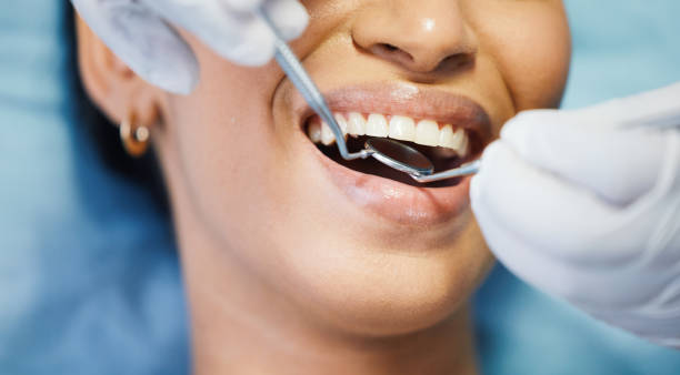 Best Knocked-Out Tooth Emergency  in Kingston, RI